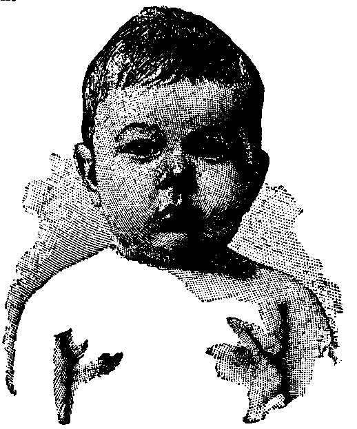 Head Shot of a Baby