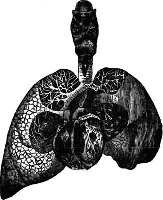 Illustrating the shrunken condition of one of the Lungs of an excessive smoker