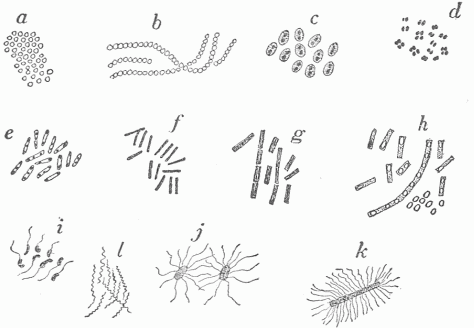 Fig. 17.—Various Forms Of Bacteria. a, b, c, d, Round bacteria or cocci: (a) Staphylococci, organisms which occur in groups and a common cause of boils; (b) streptococci, organisms which occur in chains and produce erysipelas and more severe forms of inflammation; (c) diplococci, or paired organisms with a capsule, which cause acute pneumonia; (d) gonococci, with the opposed surfaces flattened, which cause gonorrhoea. e, f, g, h, Rod-shaped bacteria or bacilli: (e) diphtheria bacilli; (f) tubercle bacilli; (g) anthrax bacilli; (h) the same bacilli in cultures and producing spores; a small group of spores is shown. (i) Cholera spirill. (j) Typhoid bacilli. (k) Tetanus bacillus; i, j, k are actively motile, motion being effected by the small attached threads. (l) The screw-shaped spirochite which is the cause of syphilis.