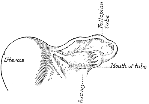 Ovarian cancer - Wikipedia, the free.