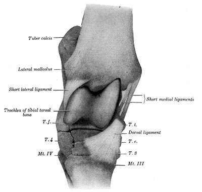 Fig. 54—Right hock joint. Viewed from the front and
slightly laterally after removal of joint capsule and long collateral
ligaments. T.t., Tibial tarsal bone (distal tuberosity). T.c., central
tarsal bone. T.3. Ridge of third tarsal bone. T.f. Fibular tarsal bone
(distal end). T.4. Fourth tarsal bone. Mt. III, Mt. IV. Metatarsal
bones. Arrow points to vascular canal. (From Sisson's ''Anatomy of the
Domestic Animals.'')