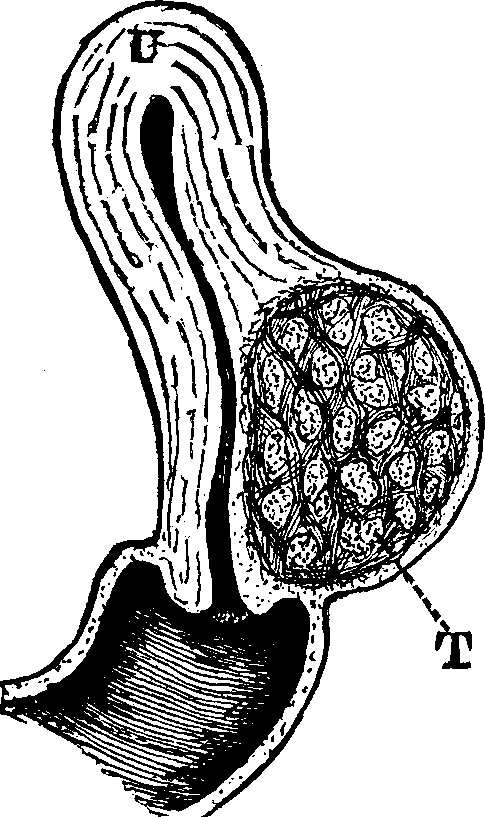 Illustration: Fig. 19. U, Uterus. T, Tumor.