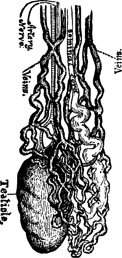 Illustration:
Fig. 3. Well developed Varicocele.