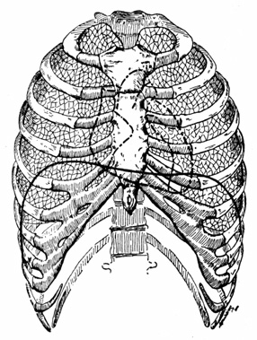Diagram of the chest cavity.