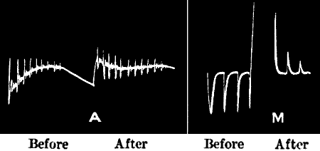 Fig. 116.—Modified Abnormal Response in (A) Nerve and (M) Metal converted into Normal, after Continuous Stimulation