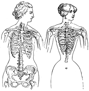 Anterior view of thorax in the Venus of Medicis.
The same in a fashionable corset-wearing lady of to-day.
