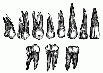 Different kinds of teeth.