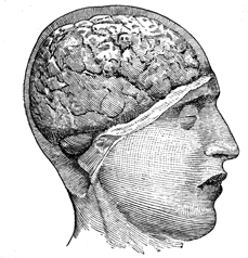 A head with a cutaway shoing the brain -- right profile.