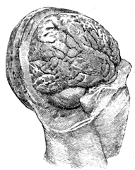 Head cutaway showing the brain: right rear.