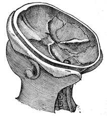Cutaway of the bottom half of the skull, looking down from the top (no brain).