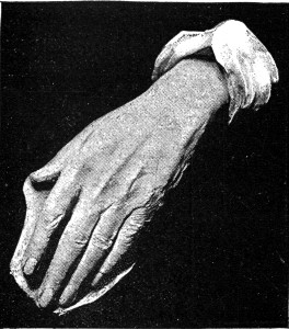CARDINAL MANNING'S HAND.