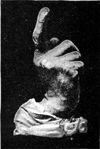 LORD BROUGHAM'S HAND.