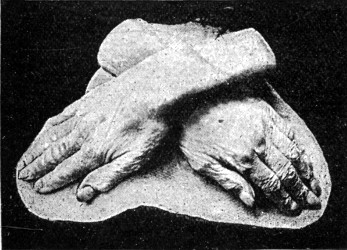 THOMAS CARLYLE'S HANDS.