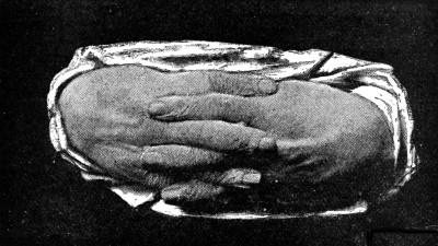 THE LATE ARCHBISHOP OF CANTERBURY'S HANDS.