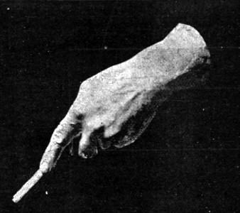 LORD MELBOURNE'S HAND.
