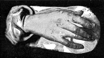 HAND OF JOHN JACKSON, R.A.