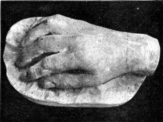 LORD ASHBURTON'S HAND.