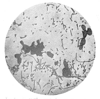 Photo-Micrograph of Preparation Made from Yoghourt, Showing Yeast Cells