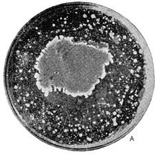 Photograph of Two Petri Dishes, which have been Inoculated with Ordinary Milk
