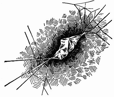 Fig. 4.—"It was Swathed Like a Mummy at Last" (p. xxiii).