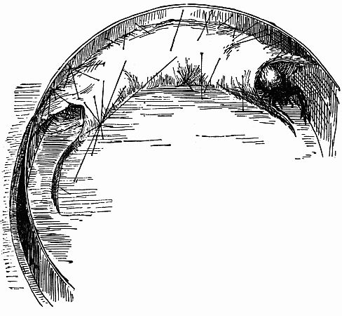 Fig. 145.—"Dysdera of the Tubeweavers."