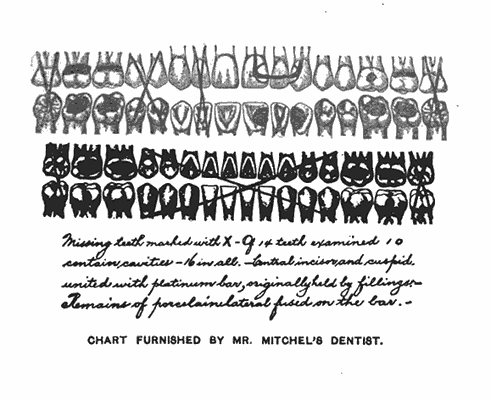Missing teeth marked with X—Of 14 teeth examined 10
contain cavities—16 in all.—Central incisor and cuspid
united with platinum bar, originally held by fillings.—
Remains of porcelain material fused on the bar.

CHART FURNISHED BY MR. MITCHEL'S DENTIST.