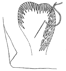 Fig. 4.—Feather or Crewel Stitch—a mixture of long and
short stitches.