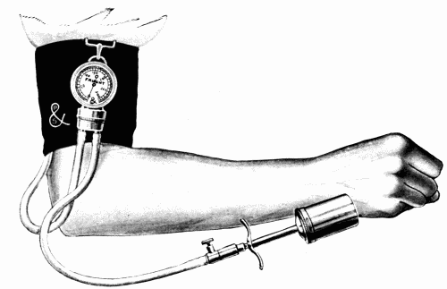Fig. 20.—Faught dial instrument.