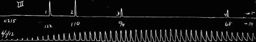 Fig. 31.—Fast drum. Sudden decrease in size of pulse wave at 4, marking the change
from clear sharp tone to dull tone.