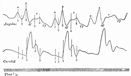 Fig. 36.—Simultaneous tracings of the jugular and carotid pulses showing normal waves
in the venous pulse and relation to carotid pulse. (After Bachmann.)