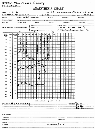 Fig. 54.—Blood pressure record from a normal reaction to ether. Note that the
systolic and diastolic rise and fall together. At the end of the anesthetization the pulse
pressure is practically the same as at the beginning. Compare this with the record in
Fig. 55, where the operation had to be discontinued on account of the onset of shock.