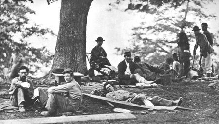 Amputees, like these Union soldiers who survived the surgeon's scalpel, would never forget the traumatic ordeal. Most wounded
went through surgery while fully conscious with but a little morphine, when available, to deaden the pain.