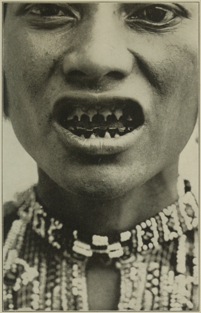 BAGOBO MAN WITH POINTED TEETH.