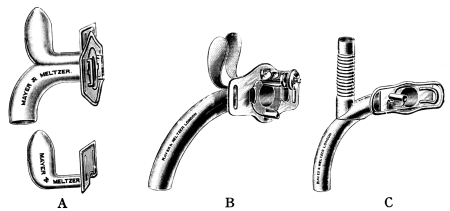 Tubes used in the Treatment of Stenosis of the Larynx