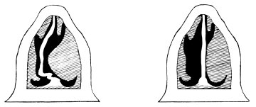 Semi-diagrammatic Transverse Section of the Nose