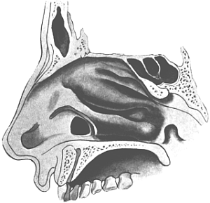 The Opening into the Maxillary Sinus from the Inferior Meatus of the Nose