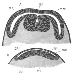 Sections of Hydropilus piceus
