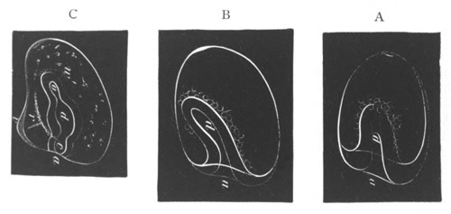 Three side views of early stages in the development of Strongylocentrus