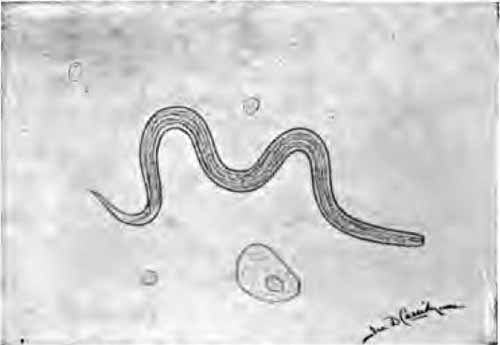 Embryo of vinegar eel