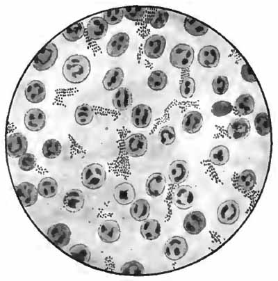 Staphylococcus pyogenes albus