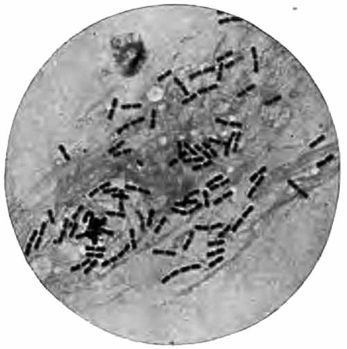 The diplobacillus of Morax and Axenfeld