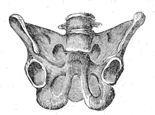Mollites Ossium deformity