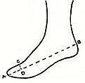 Diagram of foot in stocking