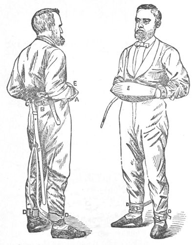 drawing of a man with hands and ankles restrained, front and back
view