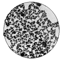 Staphylococcus Pyogenes Aureus