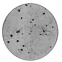 Bacillus Typhosus (Showing Flagella)