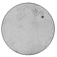 Bacillus Typhosus (Widal Reaction)