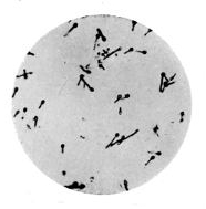 Bacillus of Tetanus