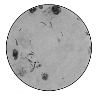 Bacillus Tuberculosis