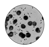 Bacillus of Plague